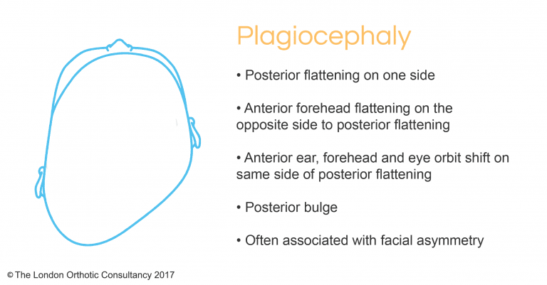 whatisplagiocephaly-768x401